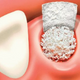 Socket preservation oral surgery