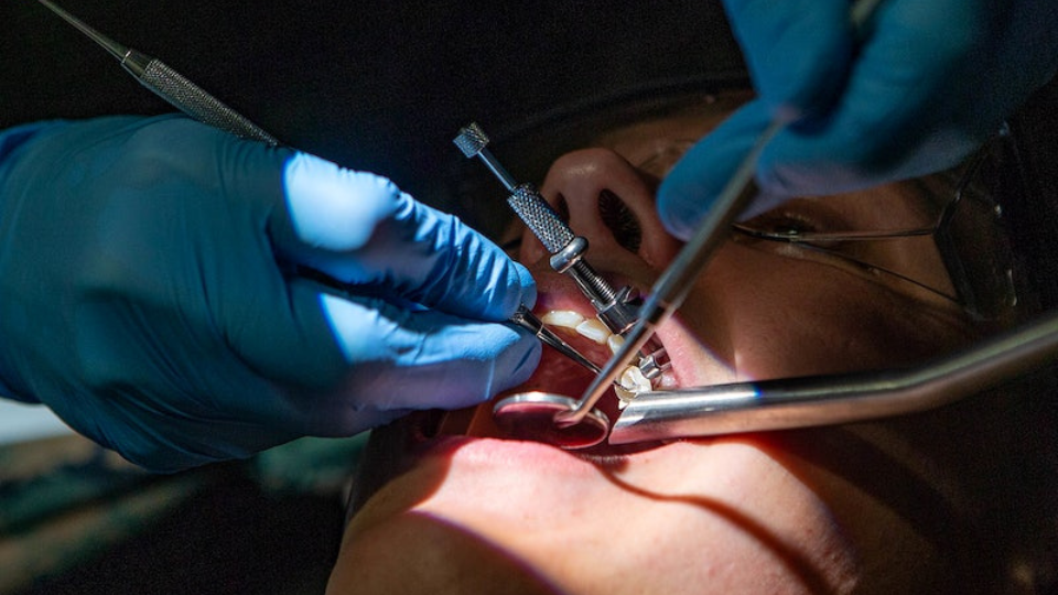 dentist performing dental surgery